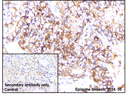 Anti-Oct-2 Rabbit mAb [89L37K21]