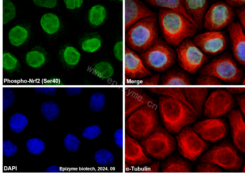 Anti-Phospho-Nrf2 (Ser40) Rabbit mAb [43K50M15]