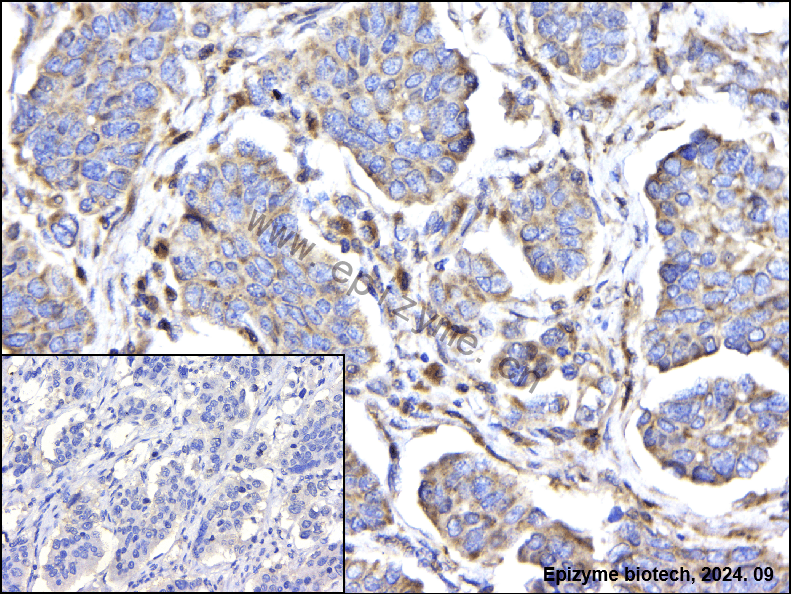 Anti-PI3K-gamma Rabbit mAb [57K12M24]
