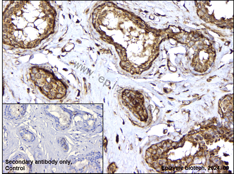 Anti-PI3K-gamma Rabbit mAb [57K12M24]
