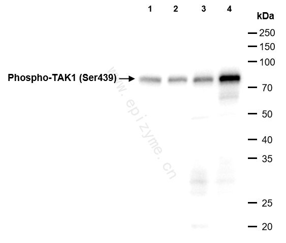 Anti-Phospho-TAK1 (Ser439) Rabbit mAb [14L92K83]