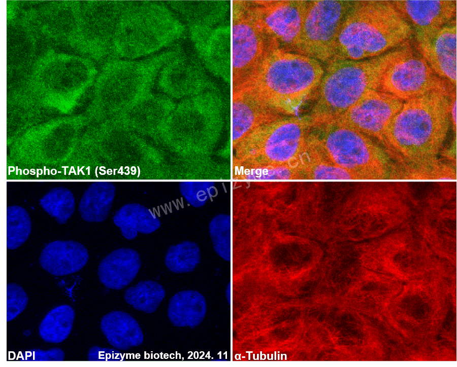 Anti-Phospho-TAK1 (Ser439) Rabbit mAb [14L92K83]