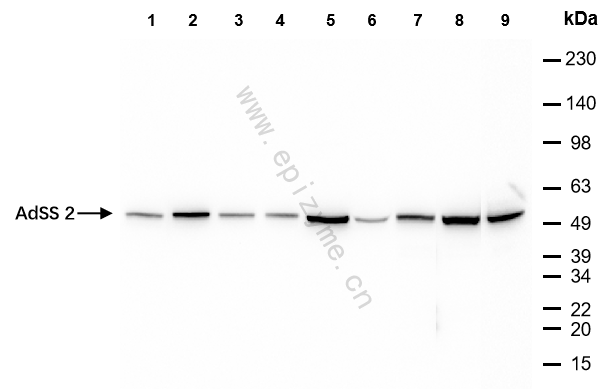 Anti-AdSS 2 Rabbit mAb [69M29K66]
