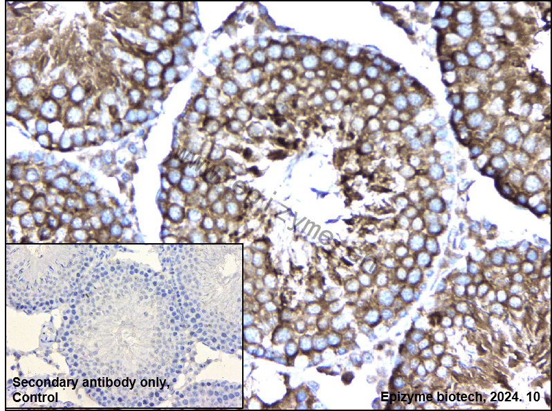 Anti-AdSS 2 Rabbit mAb [69M29K66]