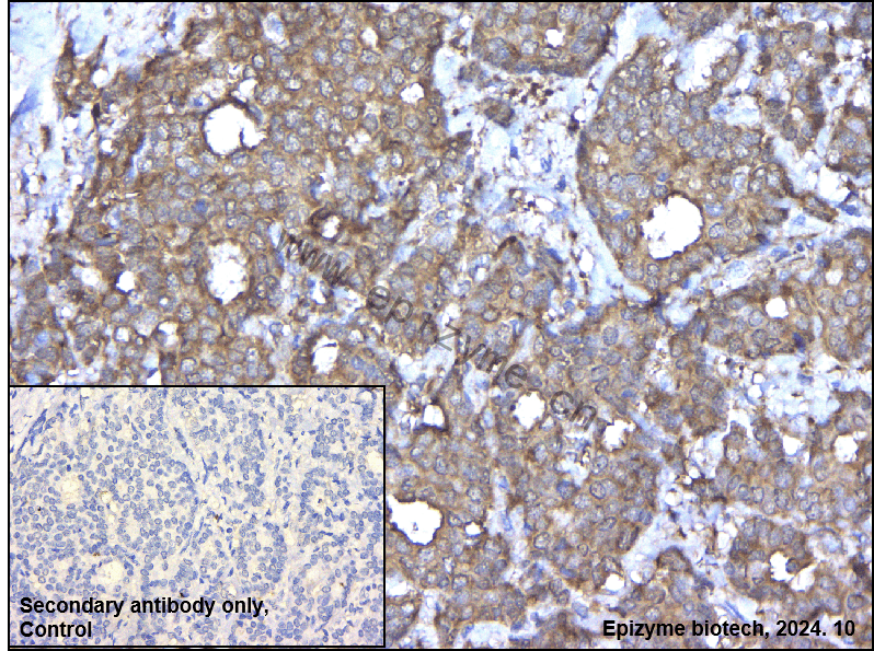 Anti-AdSS 2 Rabbit mAb [69M29K66]