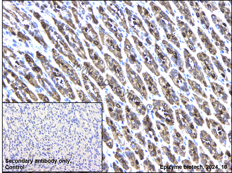 Anti-AdSS 2 Rabbit mAb [69M29K66]