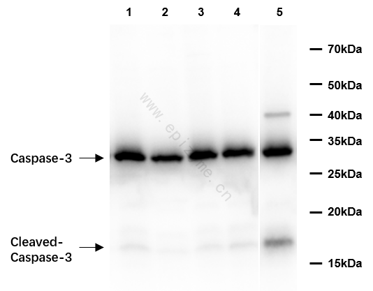 Anti-Caspase 3 Rabbit mAb [32M89K63]