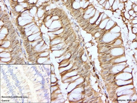 Anti-Caspase 3 Rabbit mAb [32M89K63]