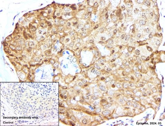 Anti-Caspase 3 Rabbit mAb [32M89K63]