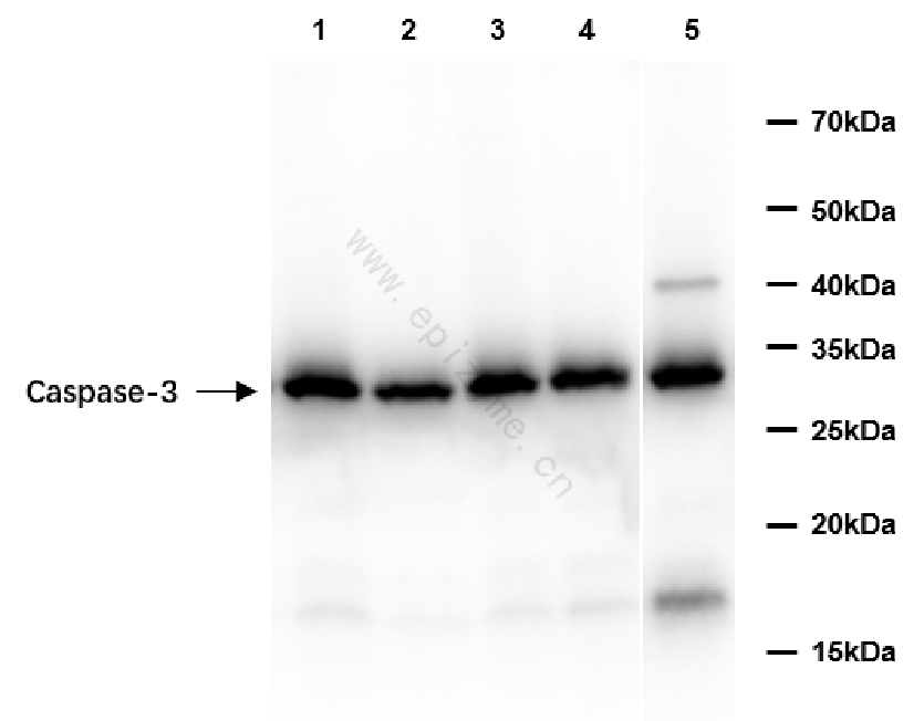 Anti-Caspase 3 Rabbit mAb [32M89K63]