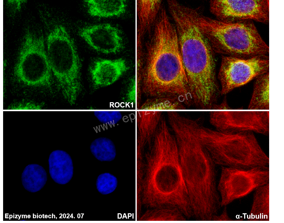 Anti-ROCK1 Rabbit mAb [32K50K74]