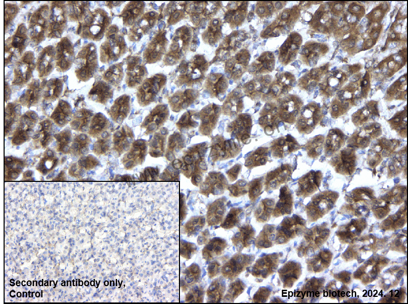 Anti-ROCK1 Rabbit mAb [32K50K74]