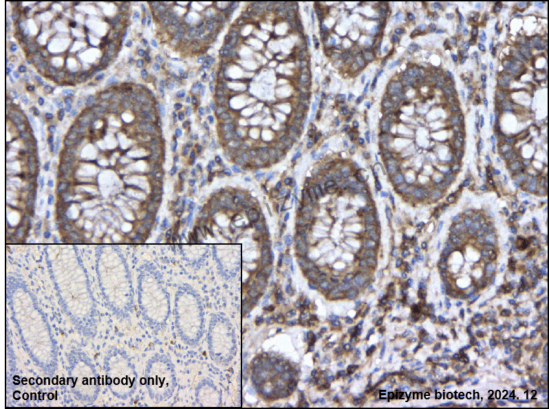 Anti-ROCK1 Rabbit mAb [32K50K74]