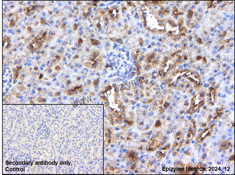 Anti-ROCK1 Rabbit mAb [32K50K74]
