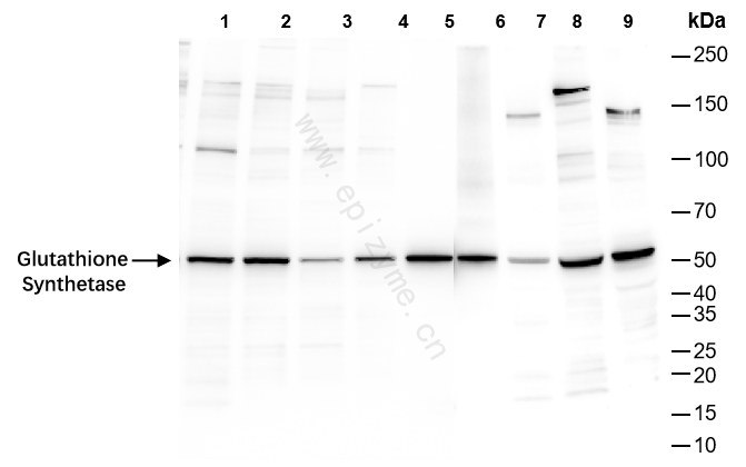 Anti-Glutathione Synthetase Rabbit mAb [15L92M58]