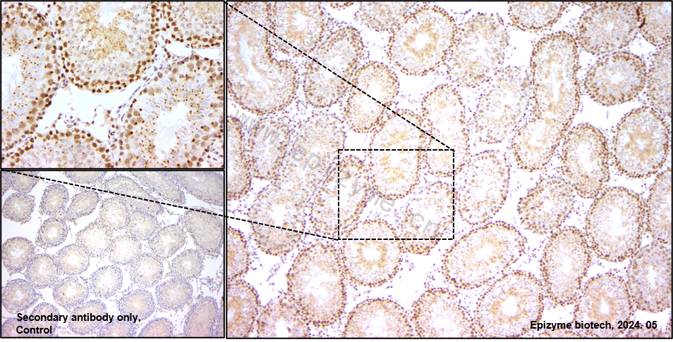 Anti-Oct-1 Rabbit mAb [53L23M31]