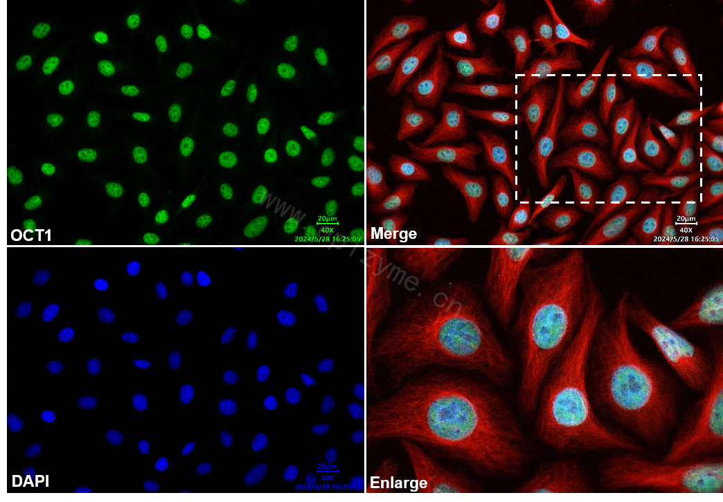 Anti-Oct-1 Rabbit mAb [53L23M31]