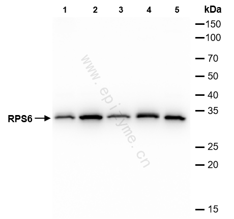 Anti-RPS6 Rabbit mAb [20M66L88]