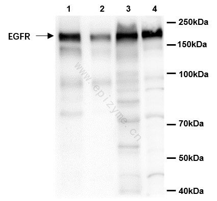 Anti-EGFR Rabbit mAb [88L43L42]