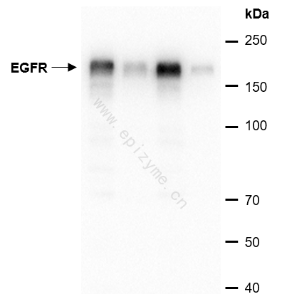 Anti-EGFR Rabbit mAb [88L43L42]