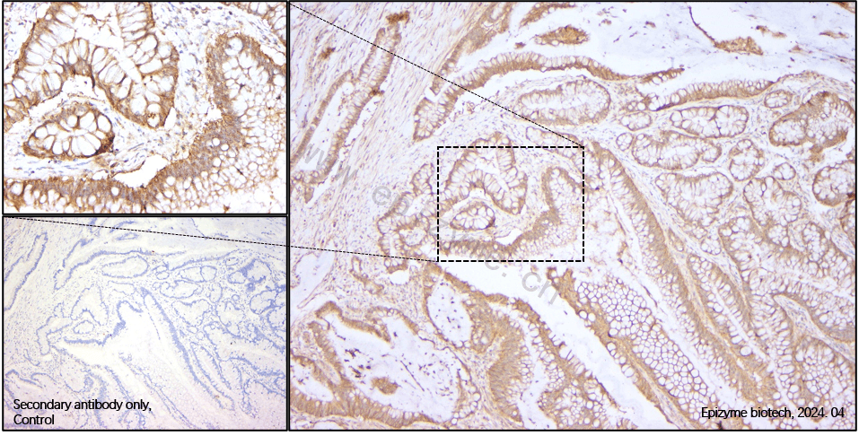 Anti-EGFR Rabbit mAb [88L43L42]