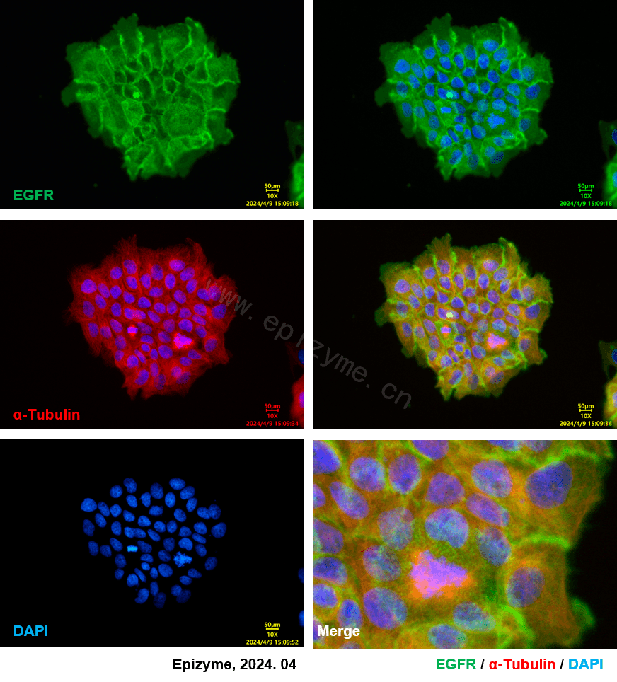 Anti-EGFR Rabbit mAb [88L43L42]