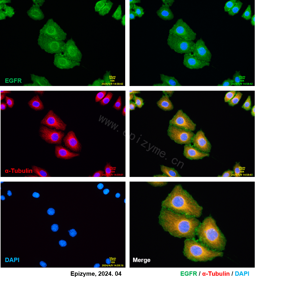 Anti-EGFR Rabbit mAb [88L43L42]