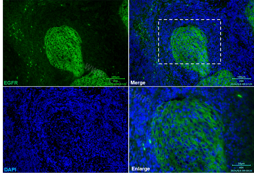 Anti-EGFR Rabbit mAb [88L43L42]