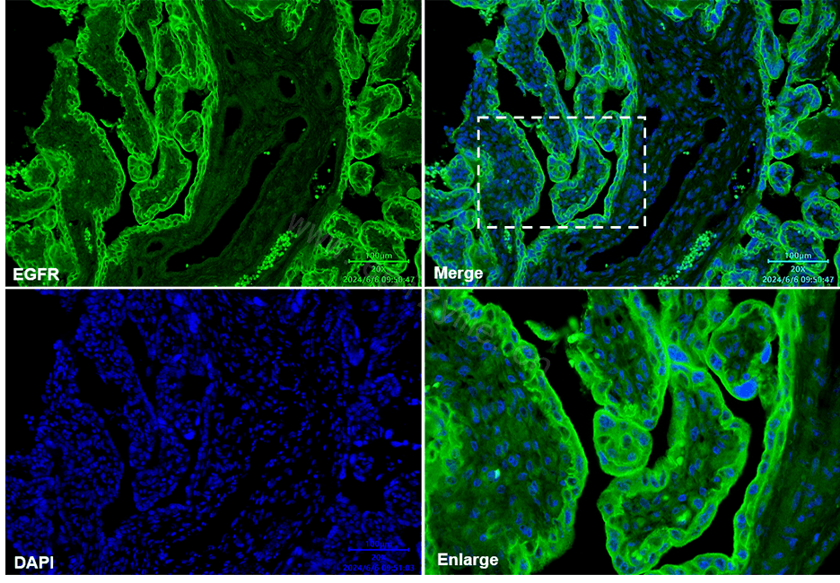 Anti-EGFR Rabbit mAb [88L43L42]