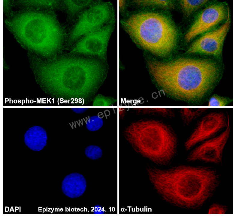 Anti-Phospho-MEK1 (Ser298) Rabbit mAb [36M99L32]