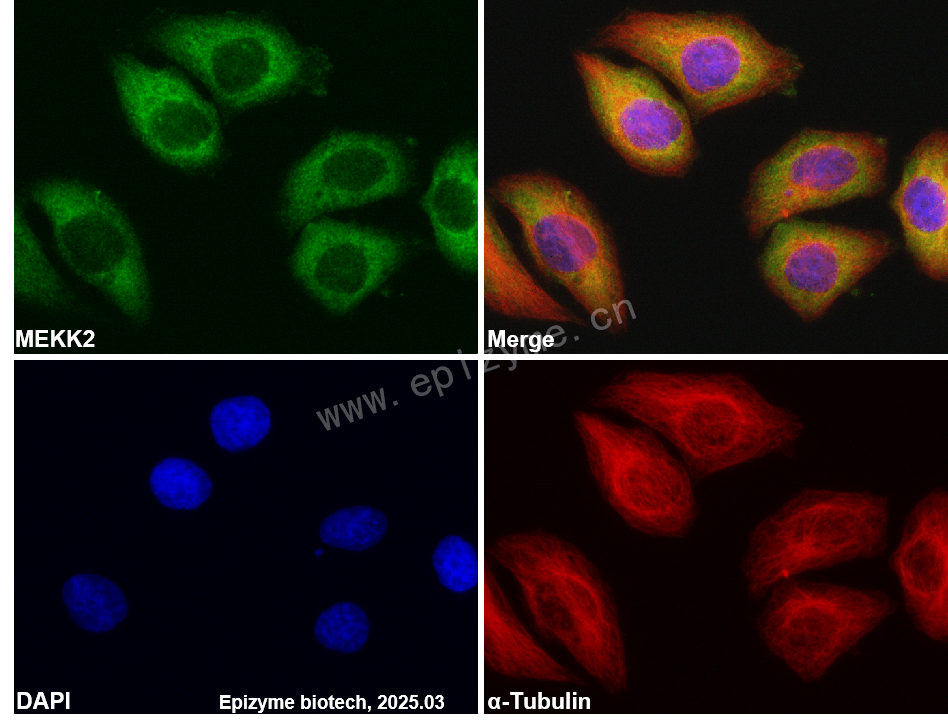 Anti-MEKK2 Rabbit mAb [75M38L27]