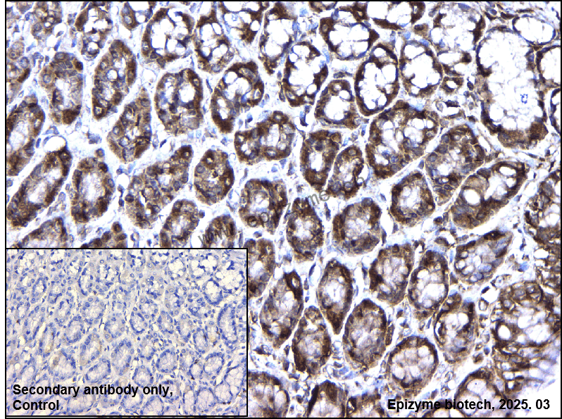Anti-MEKK2 Rabbit mAb [75M38L27]