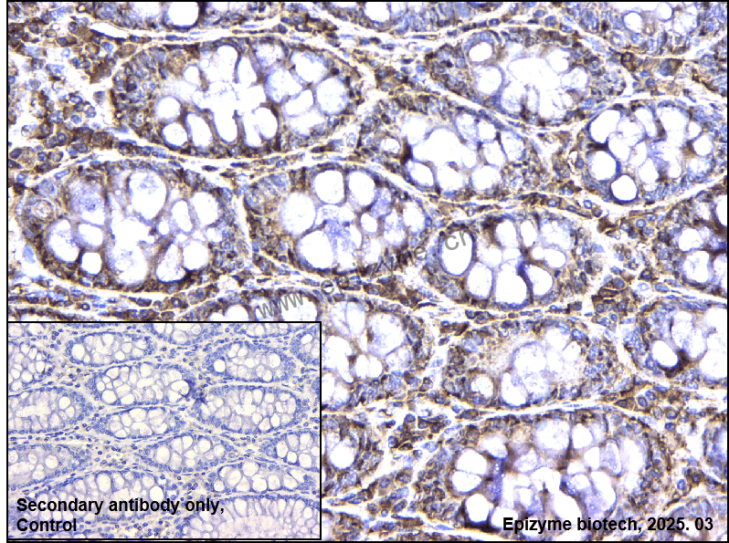 Anti-MEKK2 Rabbit mAb [75M38L27]
