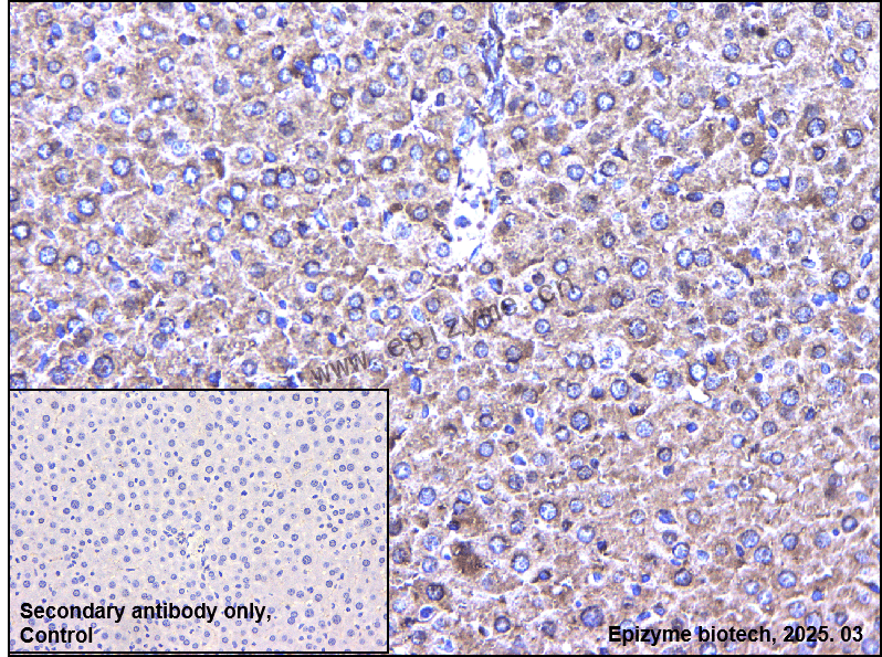 Anti-MEKK2 Rabbit mAb [75M38L27]
