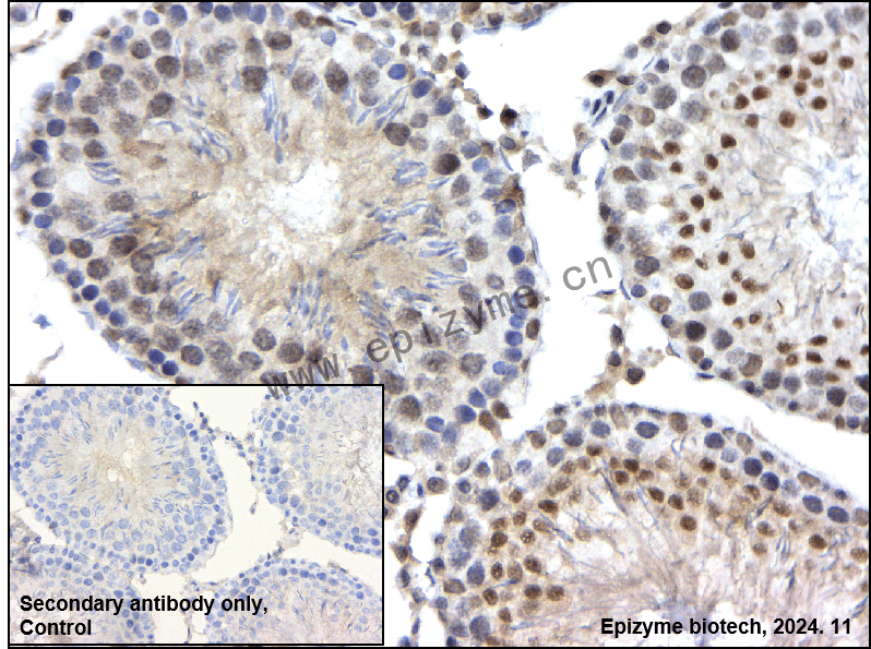 Anti-BAP1 Rabbit mAb [36K69K48]
