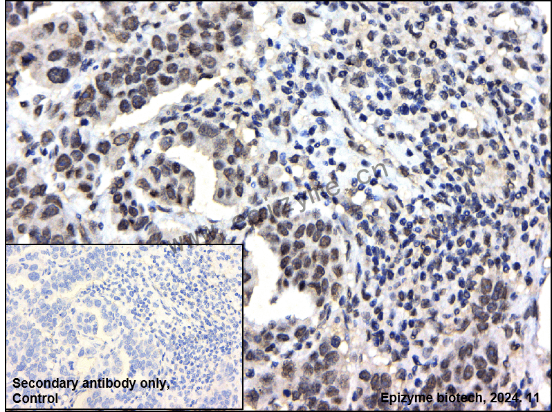 Anti-BAP1 Rabbit mAb [36K69K48]