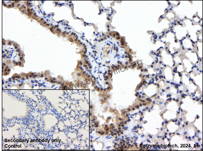 Anti-BAP1 Rabbit mAb [36K69K48]