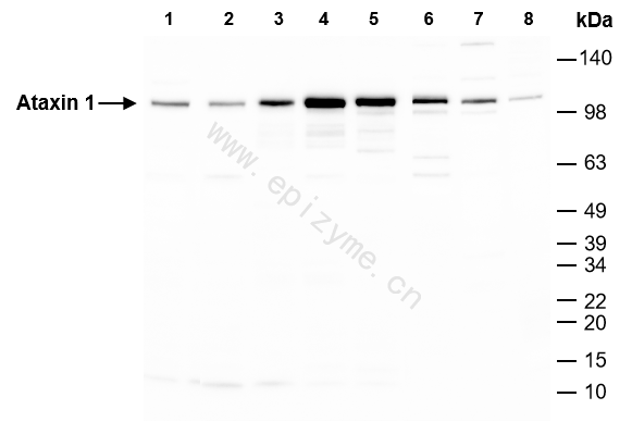 Anti-Ataxin 1 Rabbit mAb [93M26K31]