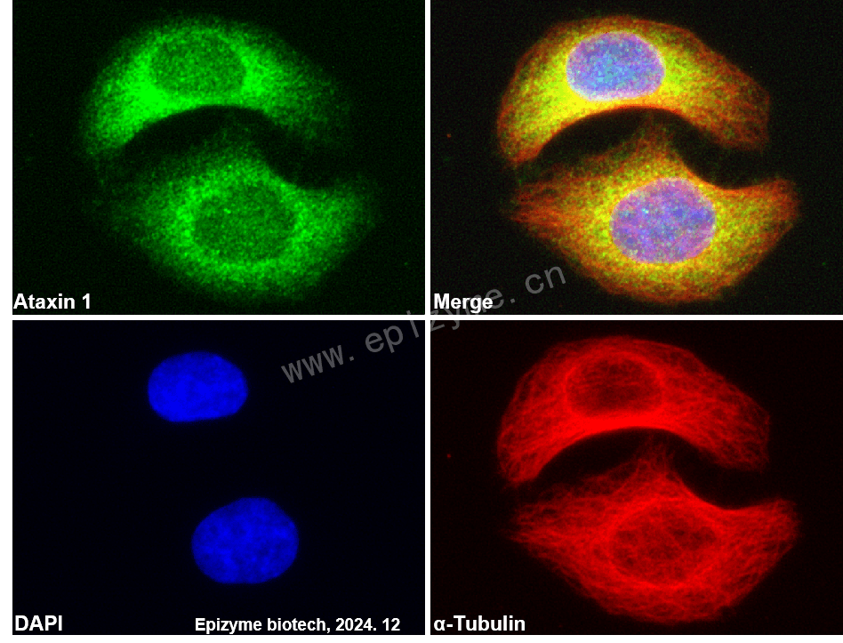 Anti-Ataxin 1 Rabbit mAb [93M26K31]