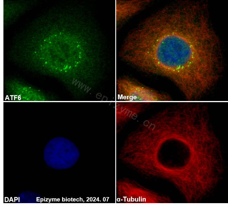 Anti-ATF6 Rabbit mAb [50K63M04]