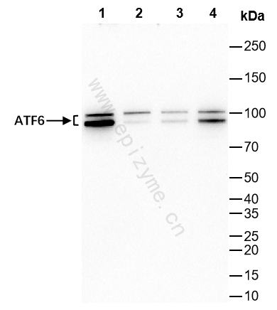 Anti-ATF6 Rabbit mAb [50K63M04]