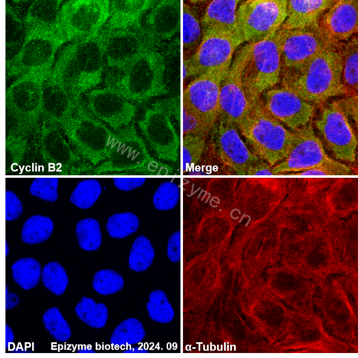 Anti-Cyclin B2 Rabbit mAb [25K68M59]
