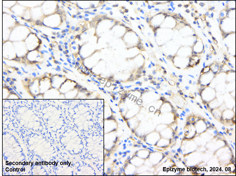 Anti-Cyclin B2 Rabbit mAb [25K68M59]