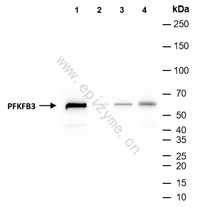 Anti-PFKFB3 Rabbit mAb [25L92L89]