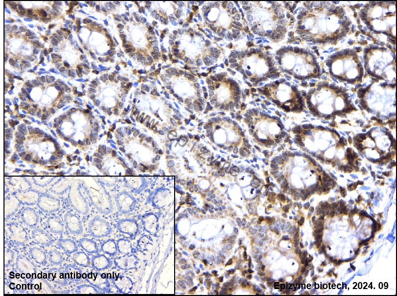 Anti-PFKFB3 Rabbit mAb [25L92L89]