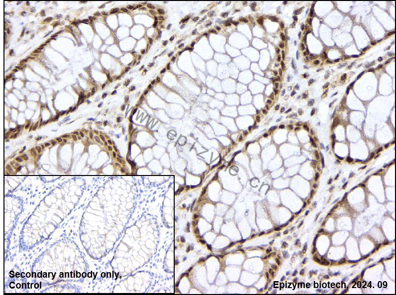 Anti-PFKFB3 Rabbit mAb [25L92L89]