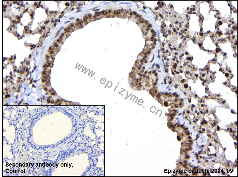 Anti-PFKFB3 Rabbit mAb [25L92L89]