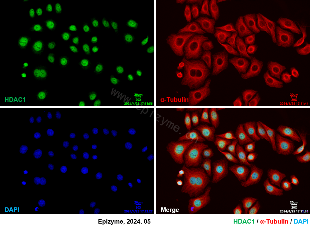 Anti-HDAC1 Rabbit mAb [80M07L65]