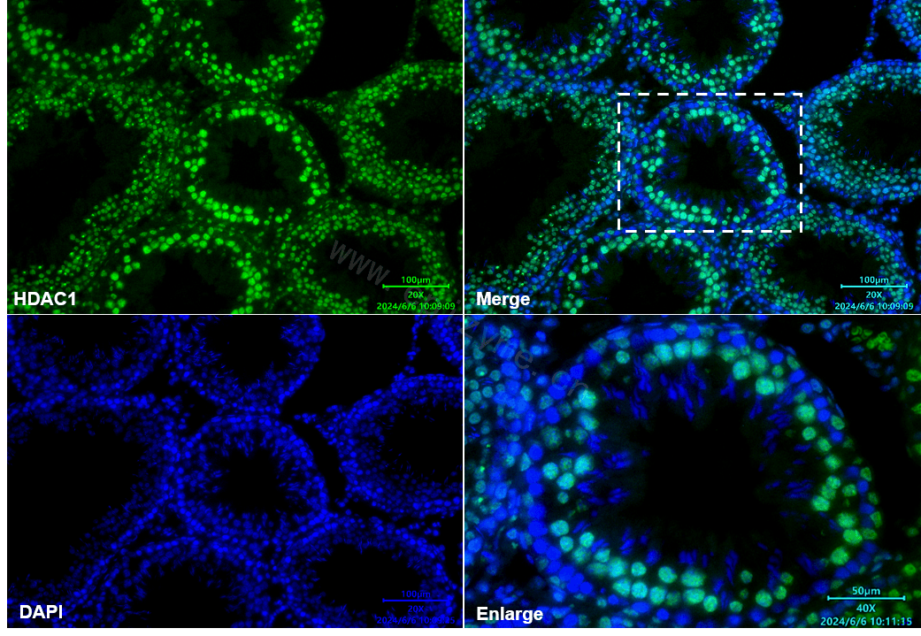 Anti-HDAC1 Rabbit mAb [80M07L65]