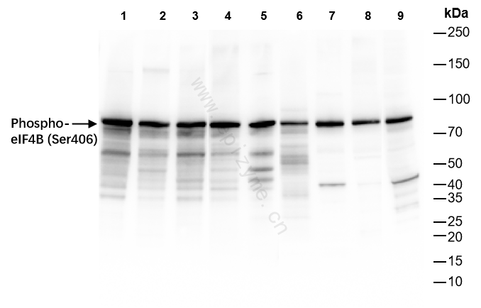 Anti-Phospho-eIF4B (Ser406) Rabbit mAb [73L05M48]